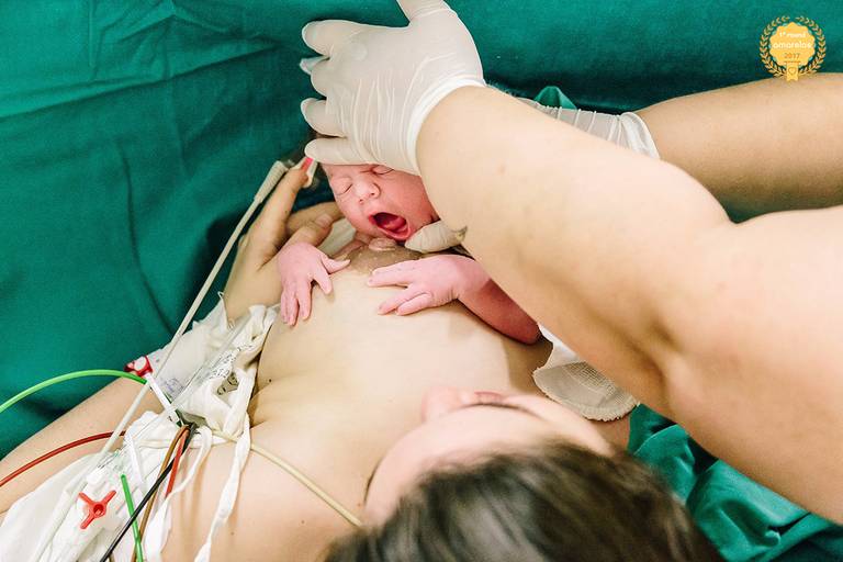 projeto pele a pele com a mae e o bebe