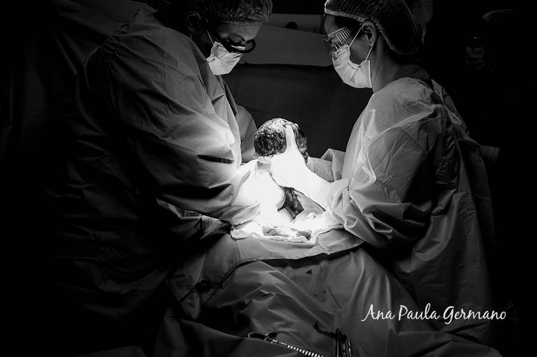 FOTOGRAFO de PARTO ABC | Hospital e Maternidade Santa Helena Saúde/São Bernardo do Campo/SP | Nascimento da Pérola 