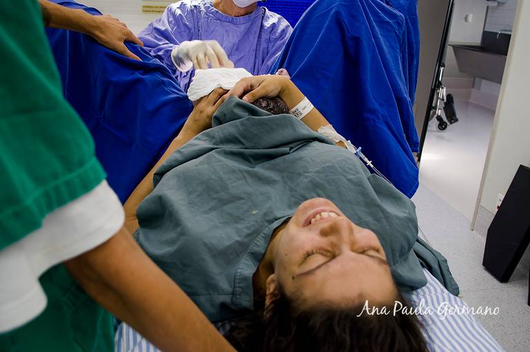Fotografia de Parto - Hospital Nossa Senhora do Rosário | NotreDame Intermédica, Zona Norte / SP