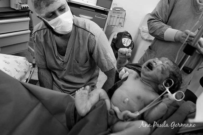 FOTOGRAFIA de PARTO/SP | Hospital SÃO LUIZ ITAIM/SP: Foto e Filmagem do NASCIMENTO