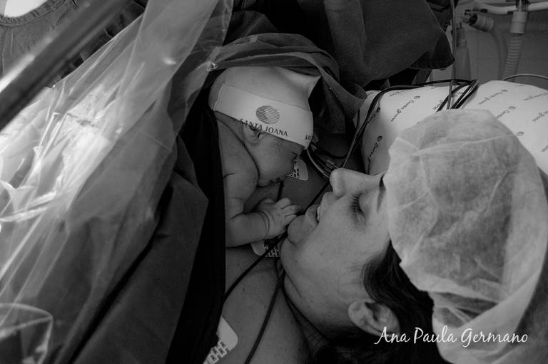 FOTOGRAFO de PARTO/SP: Parto Cesárea – Maternidade SANTA JOANA/SP