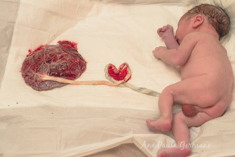 Fotografia de parto - Casa Angela, Zona Sul / SP