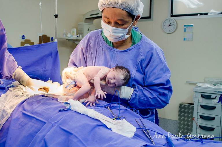 Fotografia de Parto - Hospital Nipo Brasileiro, Zona Norte / SP