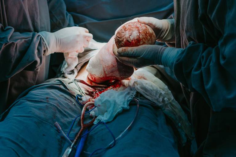 parto em hospital juliana lima