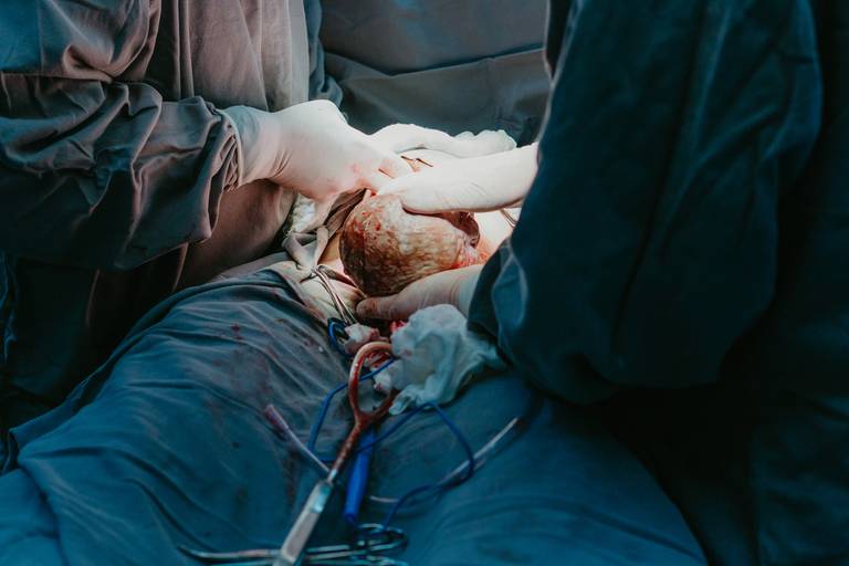 parto em hospital juliana lima