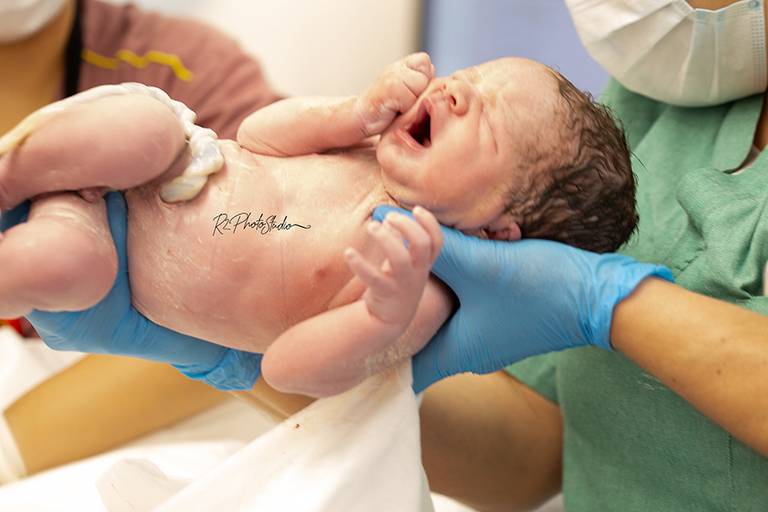 Foto do bebe tendo o cordão umbilical sendo cortado