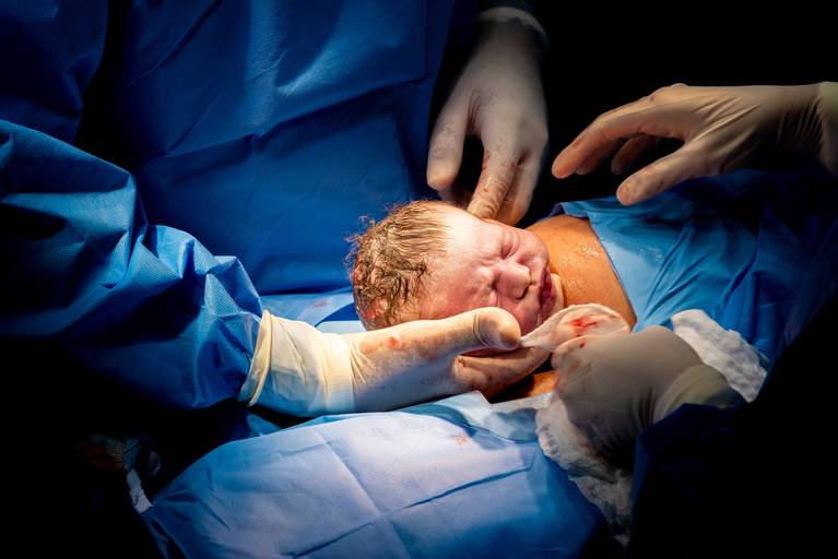 Nascimento na Perinatal - Unidade Barra da TIjuca