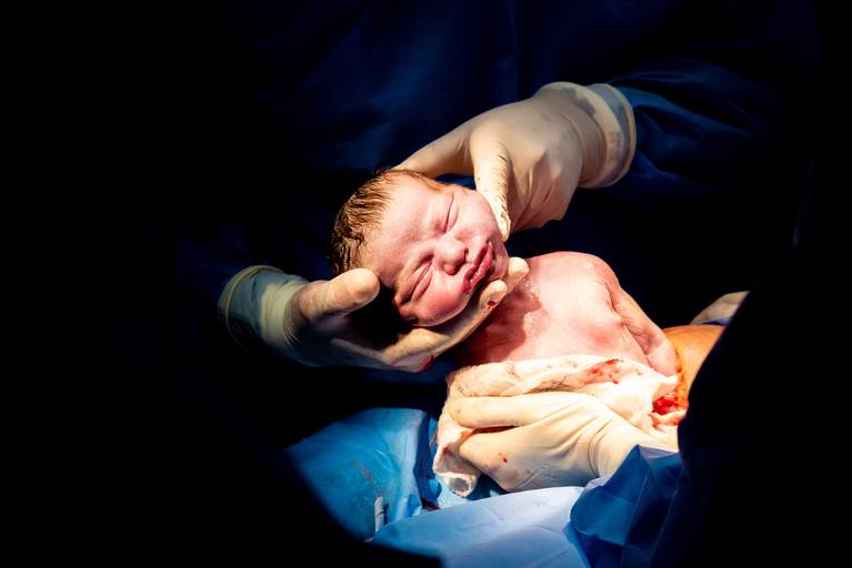 Nascimento na Perinatal - Unidade Barra da TIjuca