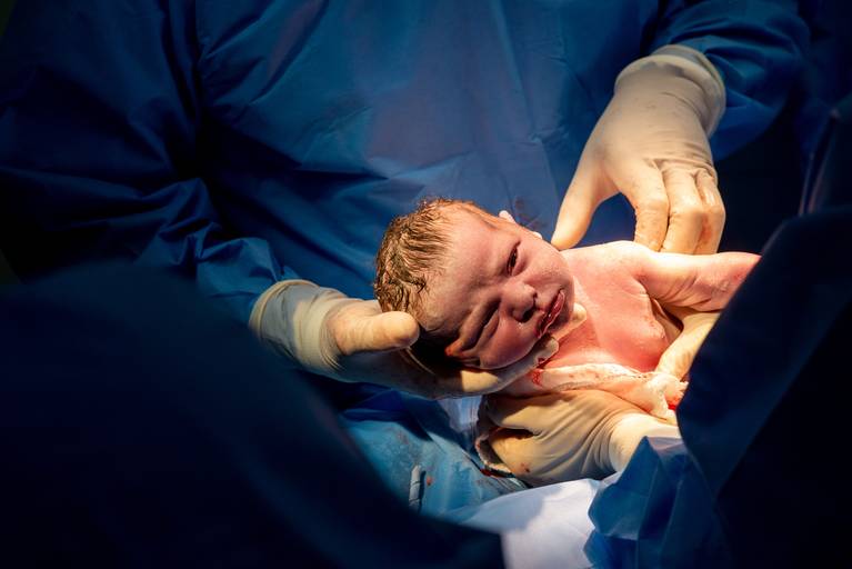 Nascimento na Perinatal - Unidade Barra da TIjuca