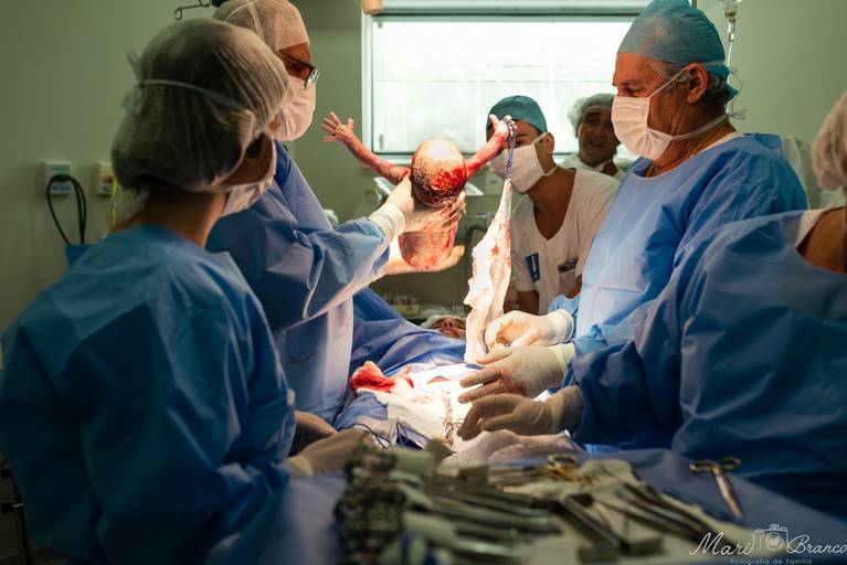 Fotografia de parto cesárea e normal em Maternidade Perinatal Barra RJ. Foto do nascimento do Arthur