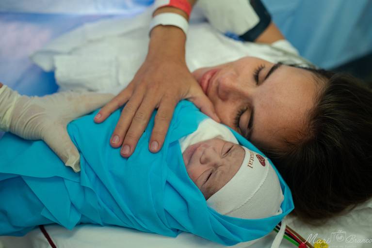 Fotografia de parto cesárea e normal em Maternidade Perinatal Barra RJ. Foto da mãe no centro cirúrgico