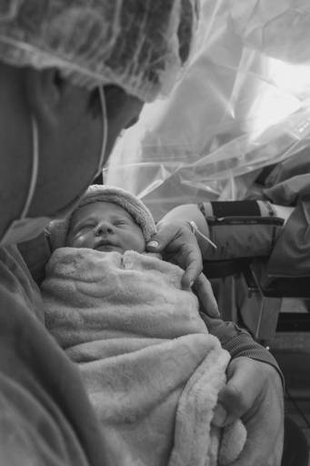 Fotos no momento do parto cesária