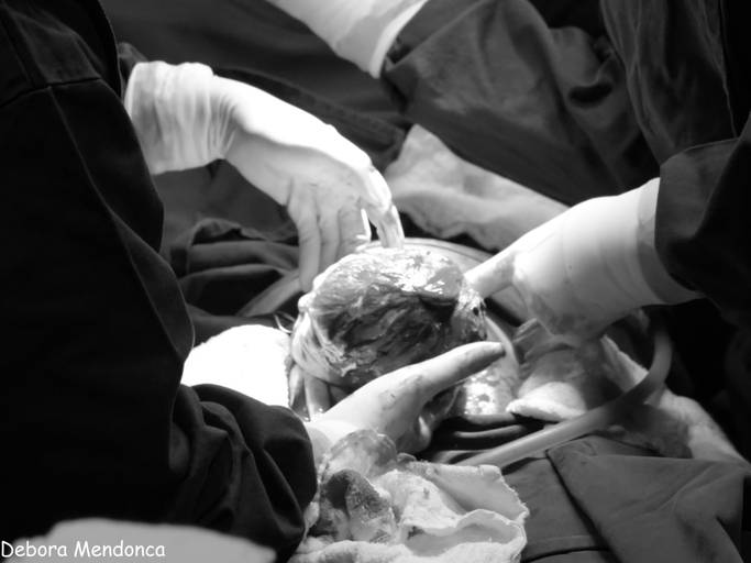 Foto parto chegada Alice