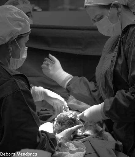 Foto parto chegada Alice