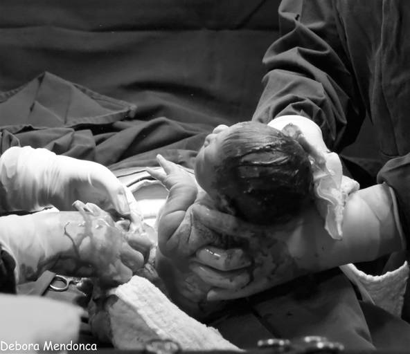 Foto parto chegada Alice