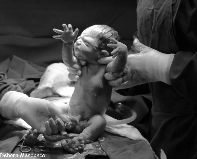 Foto parto chegada Alice