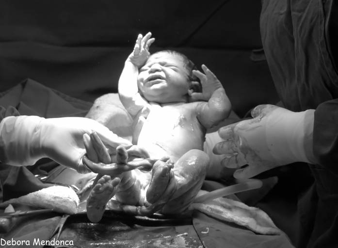 Foto parto chegada Alice