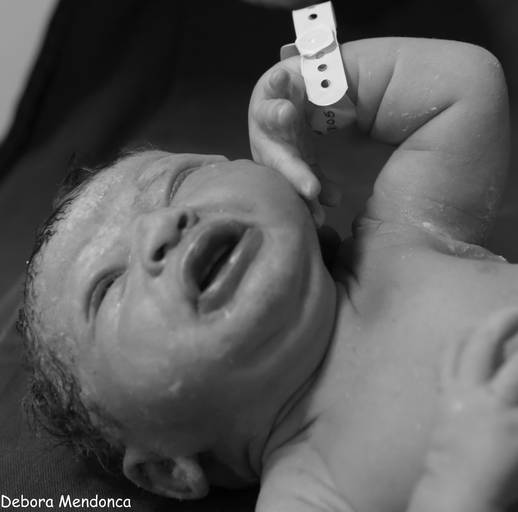 Foto parto chegada Alice