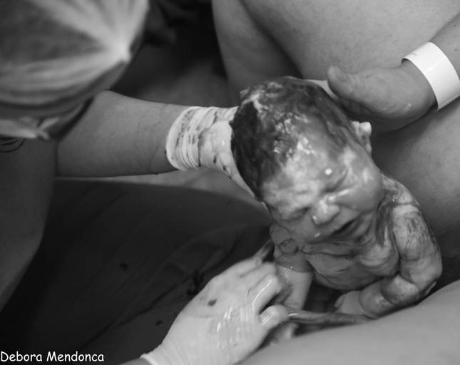 Foto de parto chegada do Enzo 