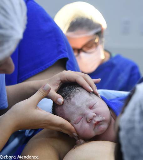 Foto do parto chegada do Enzo