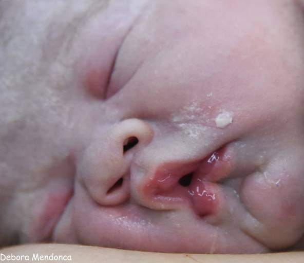 Foto de parto chegada do Enzo