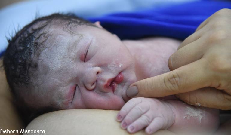 Foto de parto chegada do Enzo