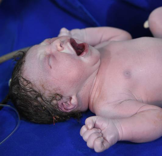 Foto de parto chegada Arthur