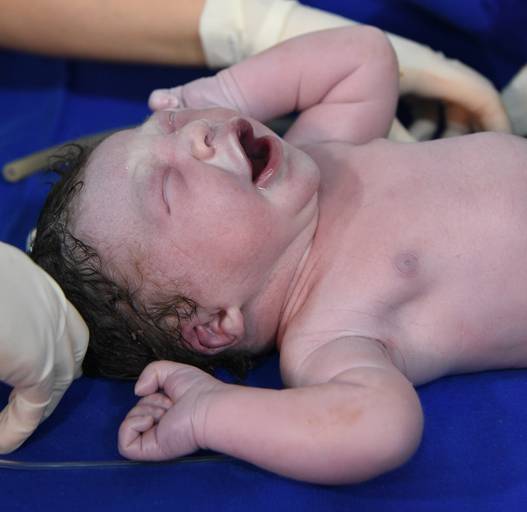 Foto de parto  chegada Arthur