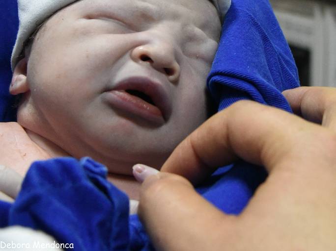 Foto parto chegada Arthur