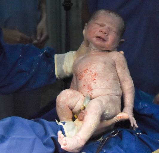 Foto de parto chegada Benjamin