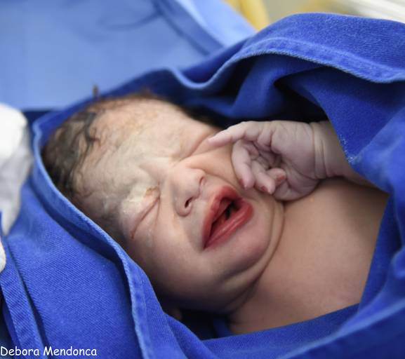 Foto parto chegada Helena