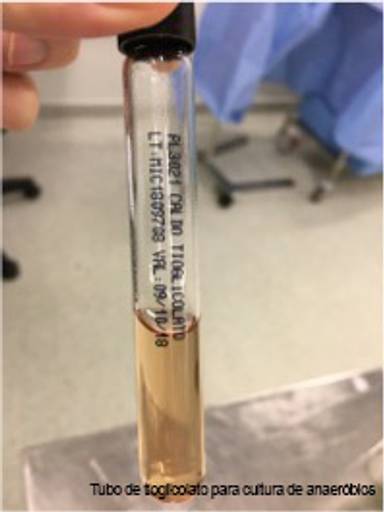 Tubo de tioglicolato para cultura de anaeróbios