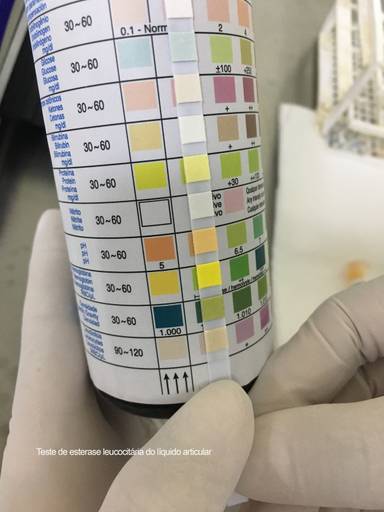 teste de esterase leucocitária do líquido articular