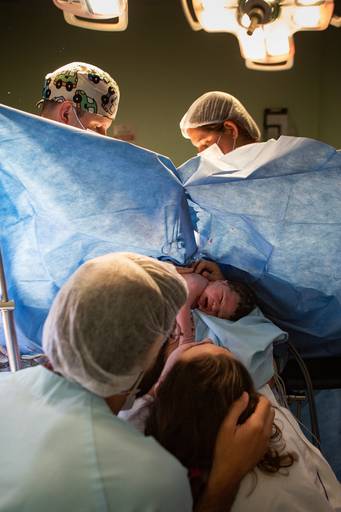 cesariana-respeitosa