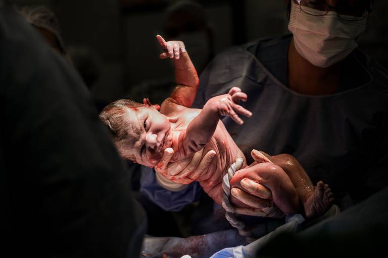 cesariana-perinatal-laranjeiras