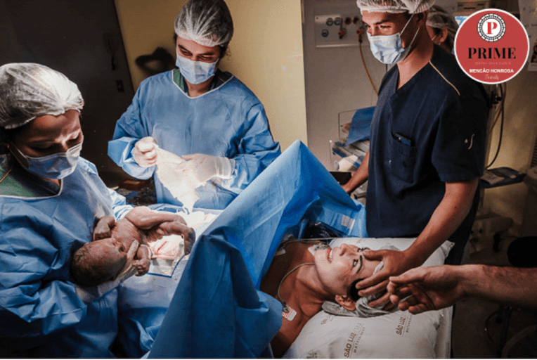 fotografia de parto cesarea