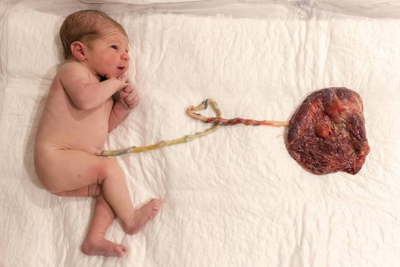 Nascimento - Parto humanizado