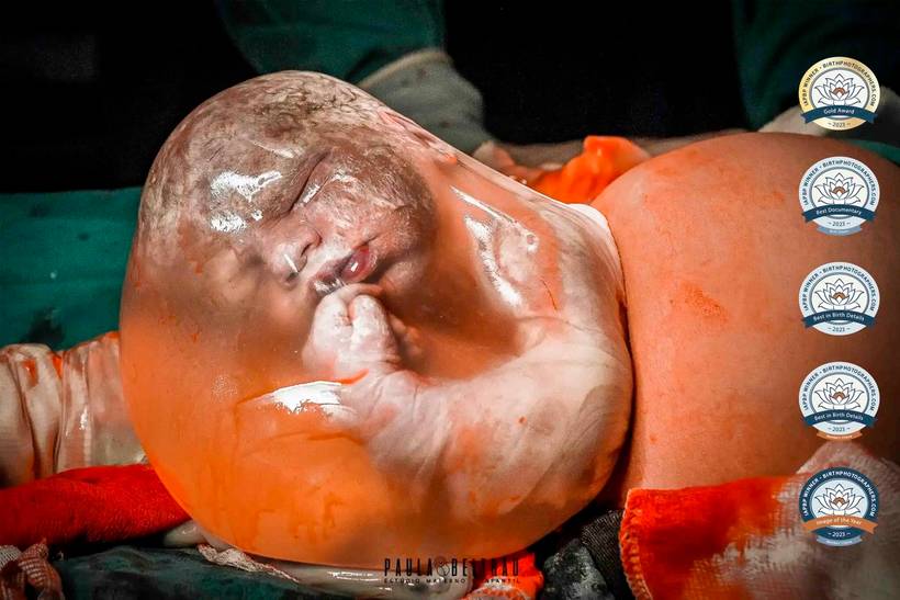 International Association of Professional Birth Photographers