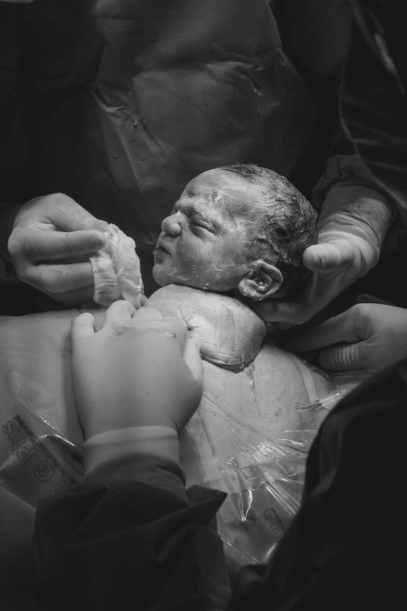 Fotos no momento do parto cesária do Valentin - 