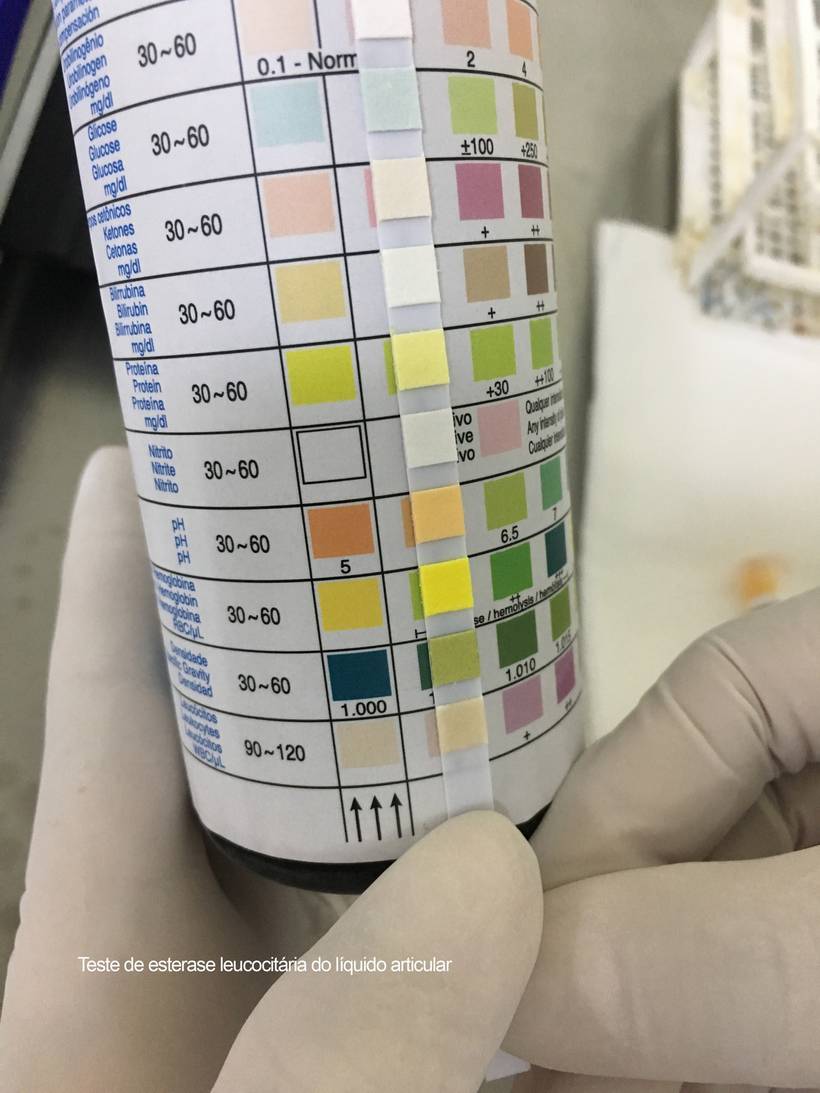 Infecção Osteoarticular