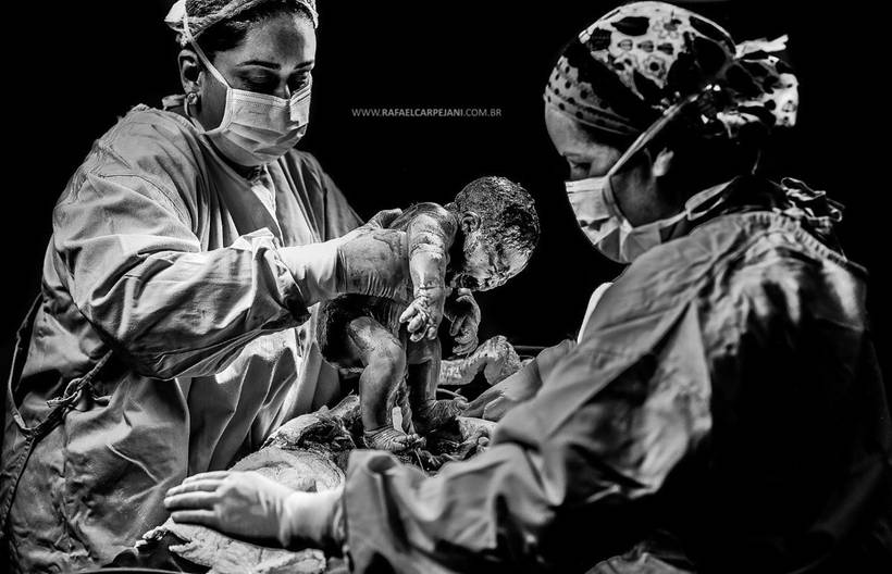 As mais incríveis imagens de nascimento...